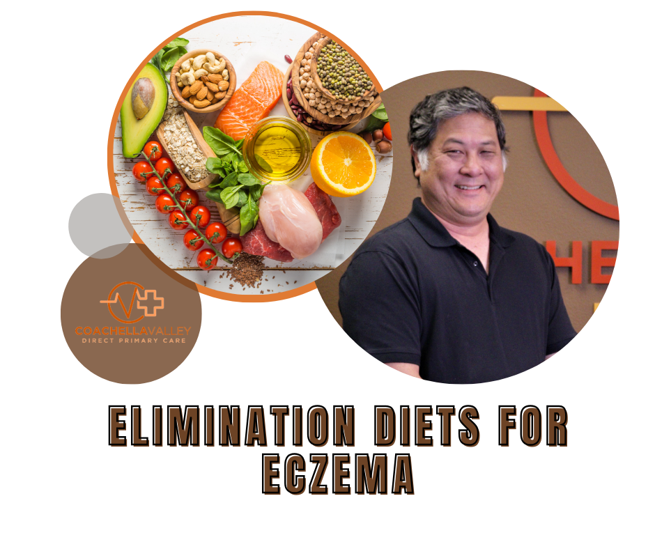 Elimination Diets for Eczema